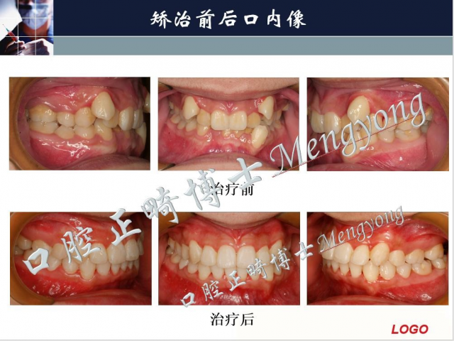孟勇 从入门到精通--正畸实战系统课程